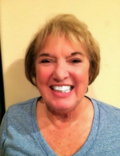 Invisalign-update25253A-my-mom-gets-her-aligners.jpg